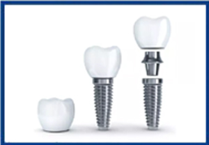 Shanti Mobident Dental Center