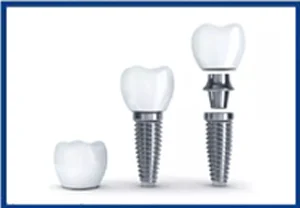 Shanti Mobident Dental Center