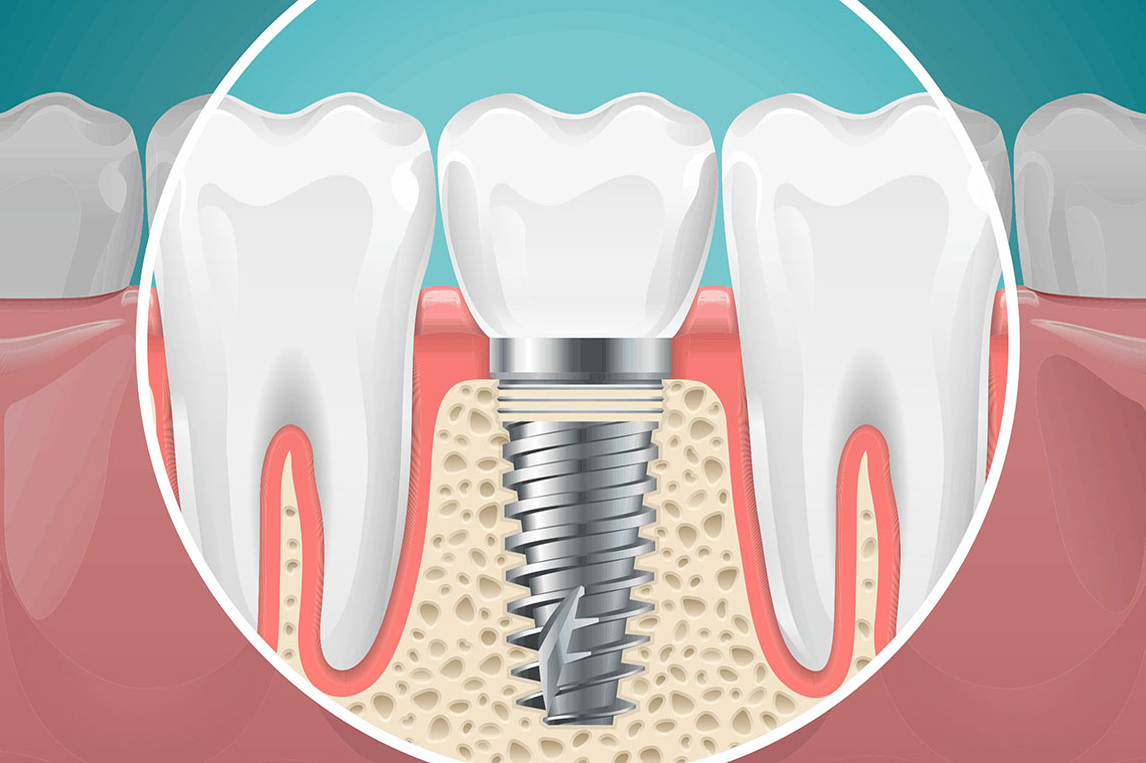 Shanti Mobident Dental Center