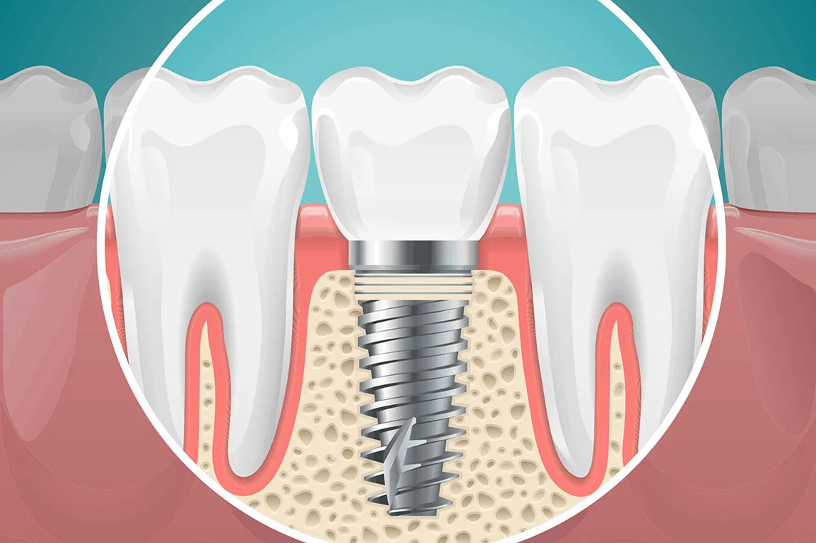 Shanti Mobident Dental Center