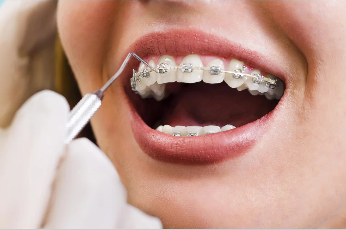 Shanti Mobident Dental Center