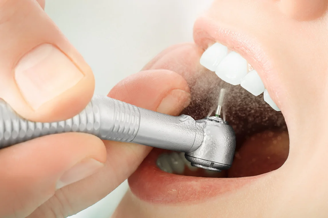 Shanti Mobident Dental Center