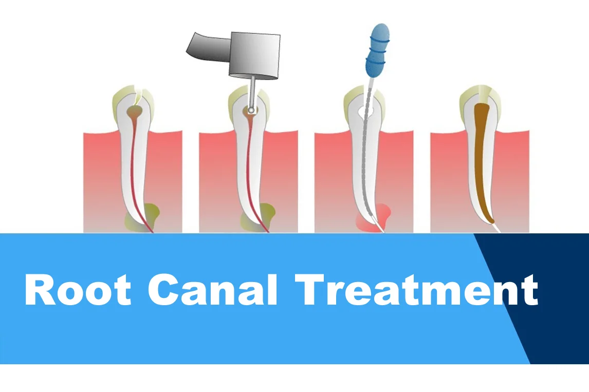 Shanti Mobident Dental Center